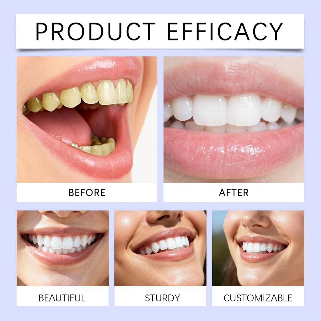 Get Whiter Teeth in Just 7 Days – No Dentist Needed